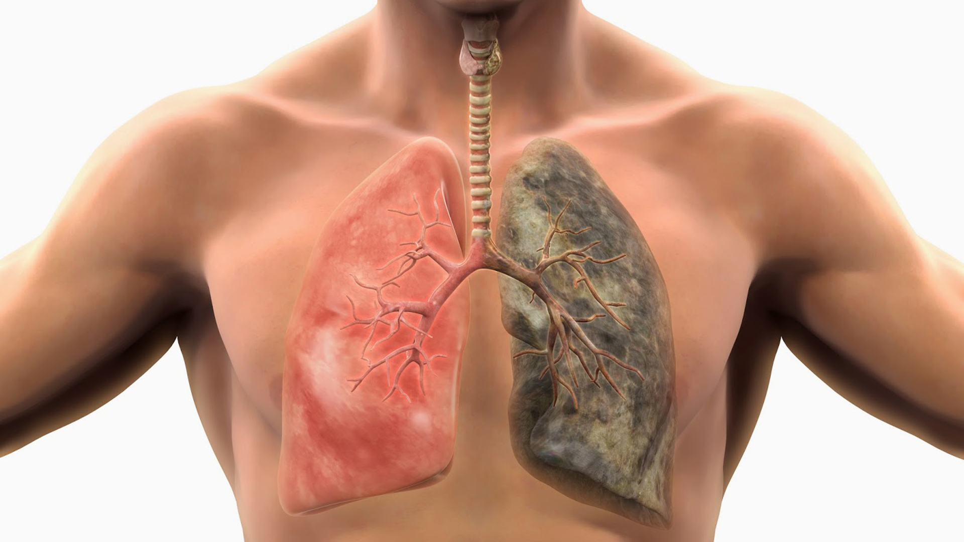 Fumatul provoacă o schimbare în celulele pulmonare propice cancerului (studiu)