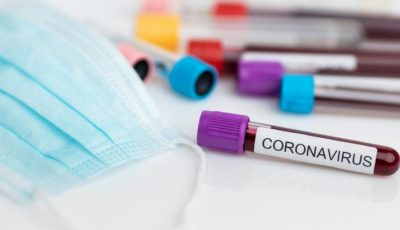 Cercetătorii de la Universitatea Oxford testează un posibil vaccin împotriva coronavirusului