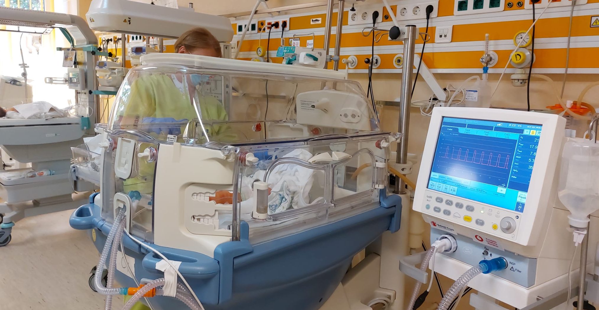 Botoșani: Secția de neonatologie a Spitalului Județean de Urgență Mavromati beneficiază de aparatură medicală nouă